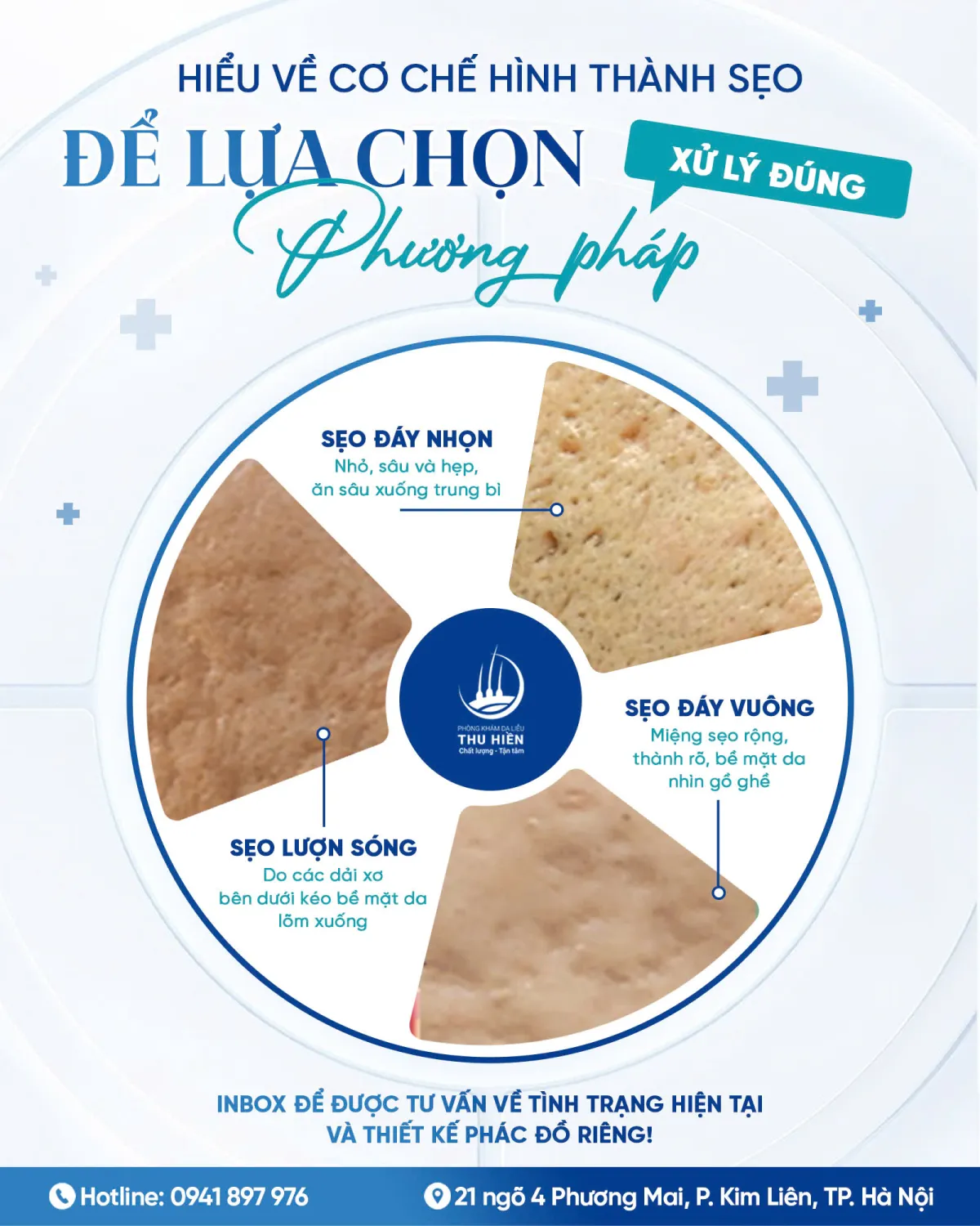 HIỂU VỀ CƠ CHẾ HÌNH THÀNH SẸO ĐỂ LỰA CHỌN PHƯƠNG PHÁP XỬ LÝ ĐÚNG