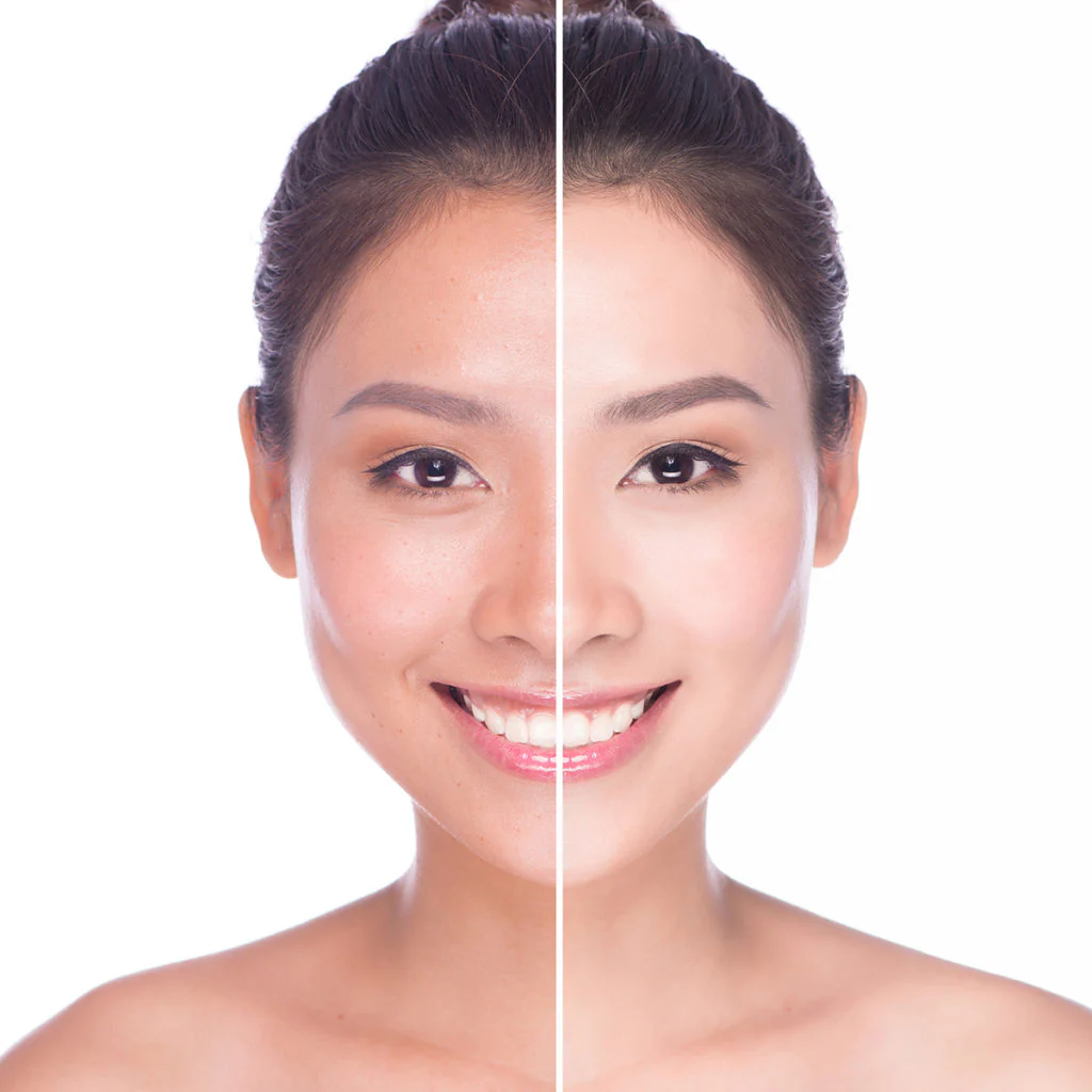 Niacinamide & Vitamin C: bộ đôi cho da thâm, xỉn màu